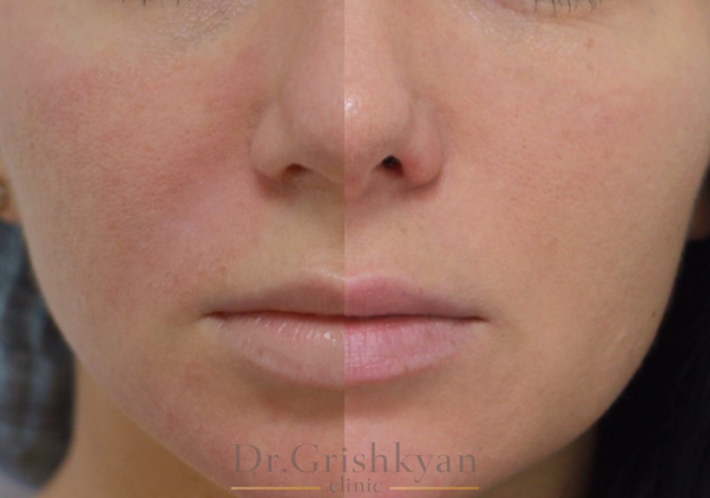 Как наша кожа реагирует на стресс. Cosmetic-clinic